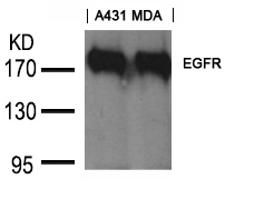 Goat Polyclonal Antibody to EGFR(Ab-1197) Goat