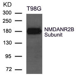 Rabbit Polyclonal Antibody to NMDANR2B Subunit
