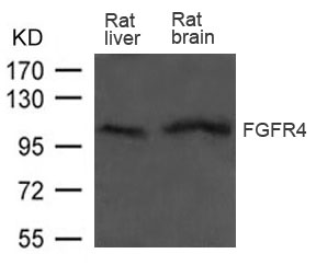 Rabbit Polyclonal Antibody to FGFR4