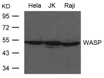 Rabbit Polyclonal Antibody to WASP