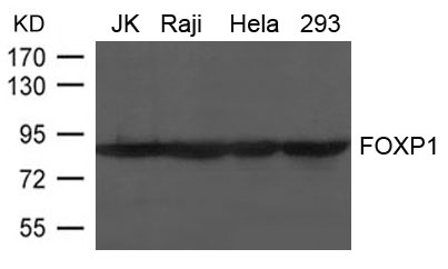 Rabbit Polyclonal Antibody to FOXP1