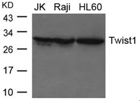 Rabbit Polyclonal Antibody to Twist1