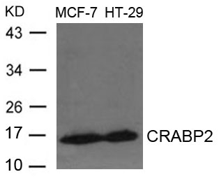 Rabbit Polyclonal Antibody to CRABP2
