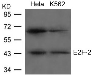 Rabbit Polyclonal Antibody to E2F-2