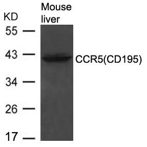 Rabbit Polyclonal Antibody to CCR5(CD195)
