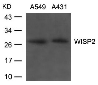 Rabbit Polyclonal Antibody to WISP2