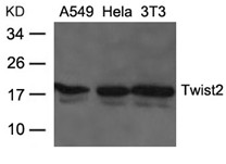 Rabbit Polyclonal Antibody to Twist2
