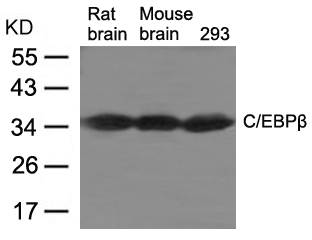 Rabbit Polyclonal Antibody to C/EBPb