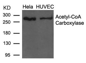 Rabbit Polyclonal Antibody to Acetyl-CoA Carboxylase(Ab-79)