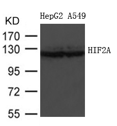 Rabbit Polyclonal Antibody to HIF2A