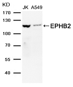 Rabbit Polyclonal Antibody to EPHB2