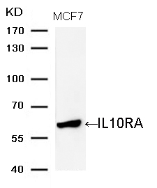 Rabbit Polyclonal Antibody to IL10RA (Ab-370)
