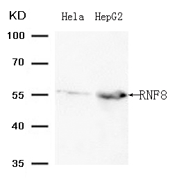 Rabbit Polyclonal Antibody to RNF8 (Ab-198 )