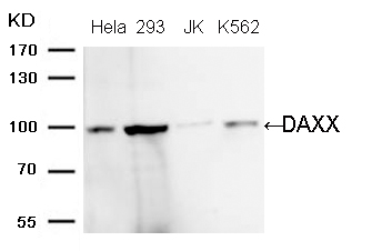 Rabbit Polyclonal Antibody to DAXX (Ab-739)
