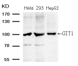 Rabbit Polyclonal Antibody to GIT1 (Ab-383)