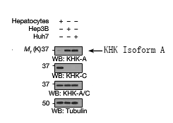 Rabbit Polyclonal Antibody to KHK Isoform A