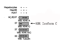 Rabbit Polyclonal Antibody to KHK Isoform C