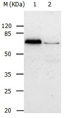 Rabbit Polyclonal Antibody to ABCB8