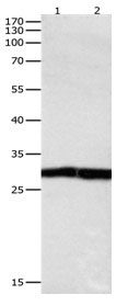 Rabbit Polyclonal Antibody to DUSP6