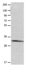Rabbit Polyclonal Antibody to AQP1