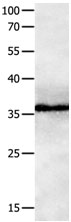 Rabbit Polyclonal Antibody to GPR3