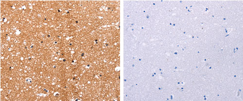 Rabbit Polyclonal Antibody to HDAC7