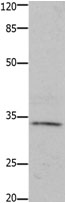 Rabbit Polyclonal Antibody to HOXA11