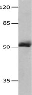Rabbit Polyclonal Antibody to MMP8