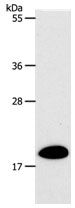 Rabbit Polyclonal Antibody to SIRT5