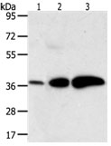Rabbit Polyclonal Antibody to AKR1C1