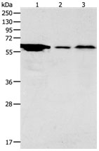 Rabbit Polyclonal Antibody to ADCYAP1R1