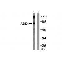 Rabbit Polyclonal Antibody to ADD1 (Ab-726)