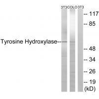 Rabbit Polyclonal Antibody to Tyrosine Hydroxylase (Ab-19)