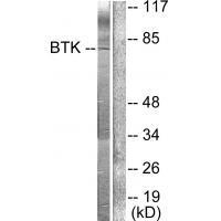 Rabbit Polyclonal Antibody to BTK (Ab-222)