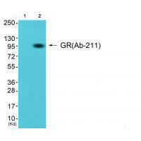 Rabbit Polyclonal Antibody to GR (Ab-211)
