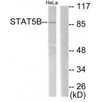 Rabbit Polyclonal Antibody to STAT5B (Ab-731)