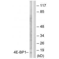 Rabbit Polyclonal Antibody to 4E-BP1 (Ab-64)