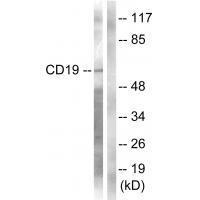 Rabbit Polyclonal Antibody to CD19 (Ab-531)