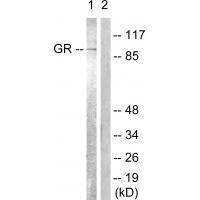 Rabbit Polyclonal Antibody to GR (Ab-226)