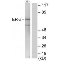 Rabbit Polyclonal Antibody to Estrogen Receptor-α (Ab-537)