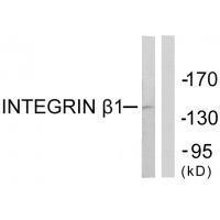 Rabbit Polyclonal Antibody to Integrin β1 (Ab-789)