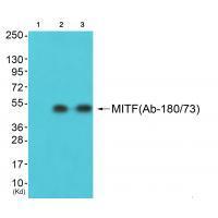 Rabbit Polyclonal Antibody to MITF (Ab-180/73)