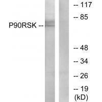Rabbit Polyclonal Antibody to p9RSK (Ab-573)