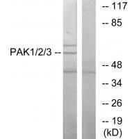 Rabbit Polyclonal Antibody to PAK1/2/3 (Ab-423/402/421)