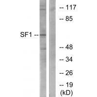 Rabbit Polyclonal Antibody to SF1 (Ab-82)
