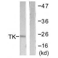 Rabbit Polyclonal Antibody to TK (Ab-13)