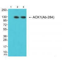 Rabbit Polyclonal Antibody to ACK1 (Ab-284)