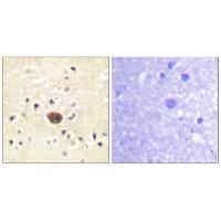 Rabbit Polyclonal Antibody to Ras-GRF1