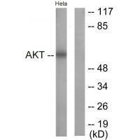 Rabbit Polyclonal Antibody to Akt (Ab-326)