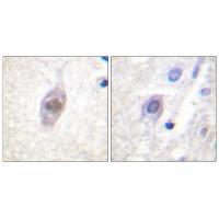 Rabbit Polyclonal Antibody to APC